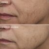 AGELESS+ Yönaamio 0,5 % retinolilla
