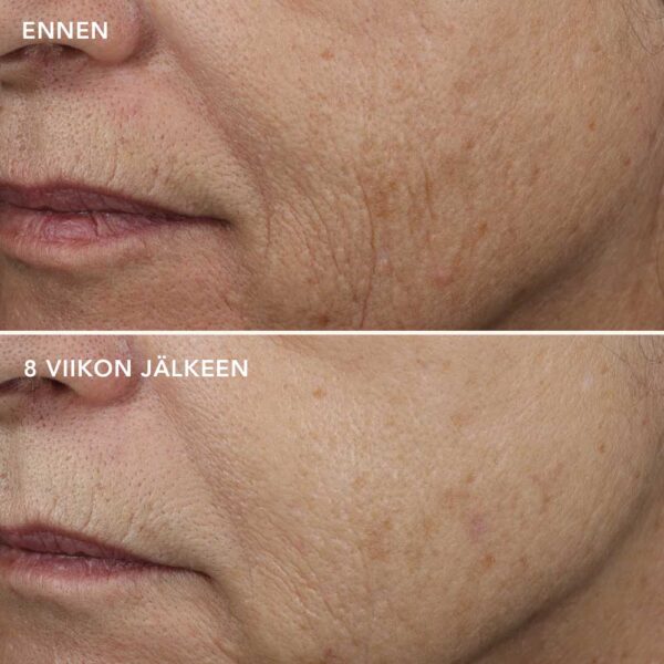 AGELESS+ Yönaamio 0,5 % retinolilla