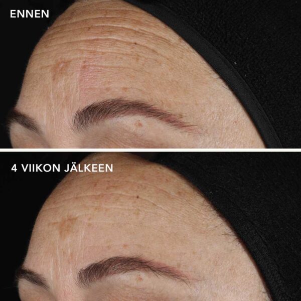 AGELESS+ Retinoliseerumi 0,1%