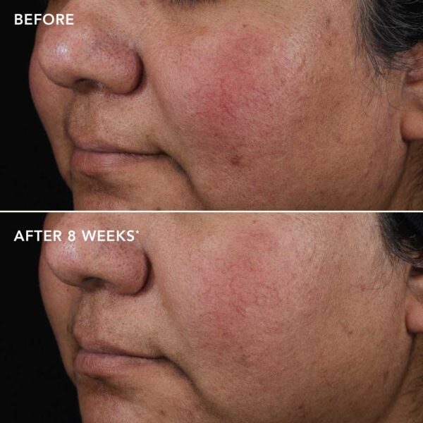 DISCOVERY AGELESS+ Retinoliseerumi 0,75%