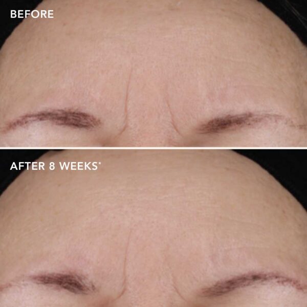 DISCOVERY AGELESS+ Retinolivoide 1,2 %