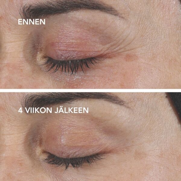 DISCOVERY AGELESS+ Retinolivoide 0,3 %