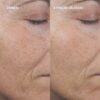 PRO AGELESS+ Retinoliseerumi 0,3%