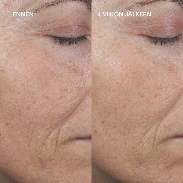 PRO AGELESS+ Retinoliseerumi 0,3%