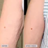 imageskincare-volulift-body-before-after1.jpg VOL.U.LIFT™ BODY kiinteyttävä vartalovoide