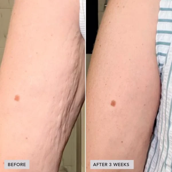 imageskincare-volulift-body-before-after1.jpg VOL.U.LIFT™ BODY kiinteyttävä vartalovoide